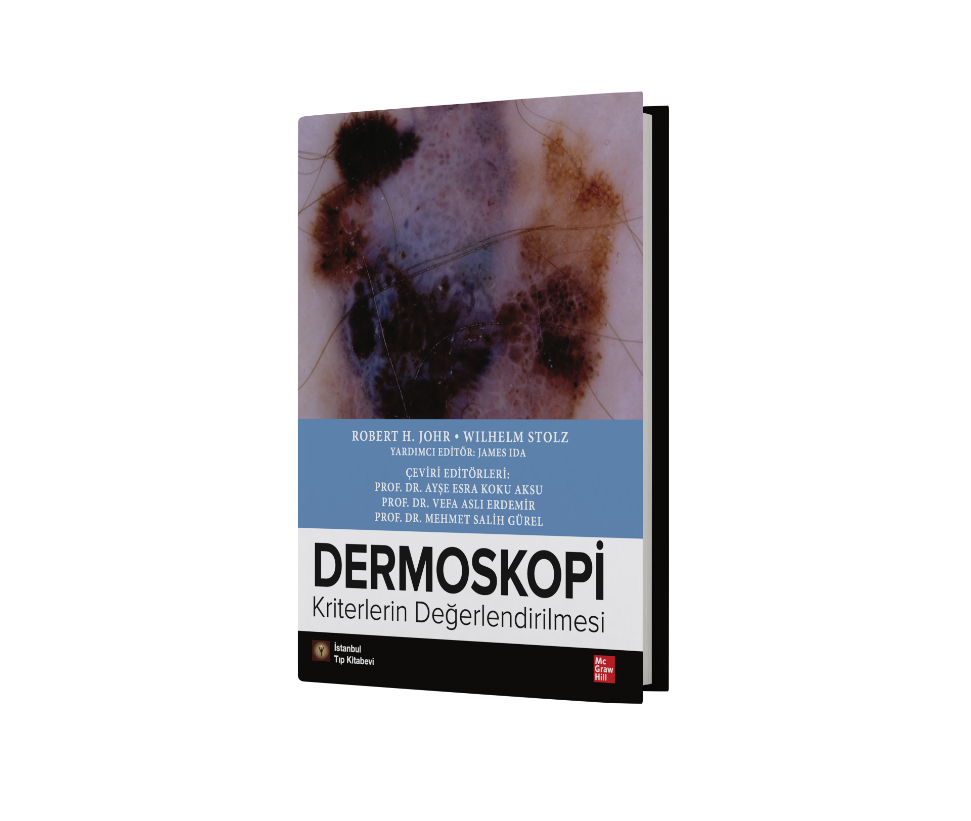 Dermoskopi Kriterlerin Değerlendirilmesi