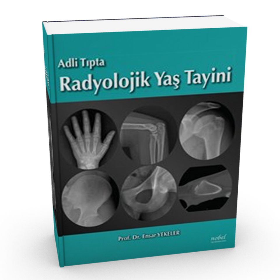 Adli Tıpta Radyolojik Yaş Tayini