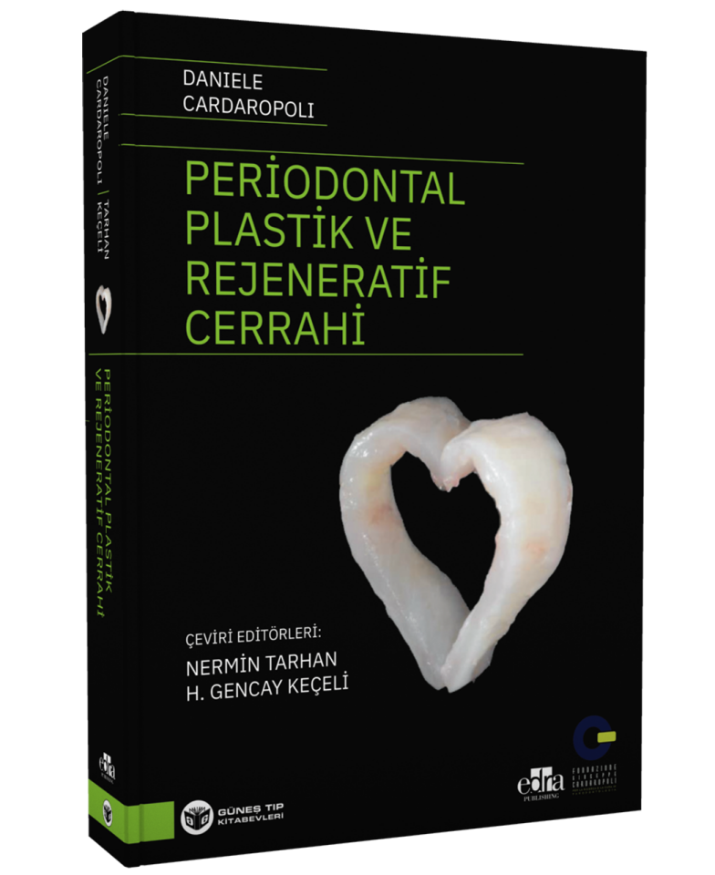 Periodontal Plastik ve Rejeneratif Cerrahi