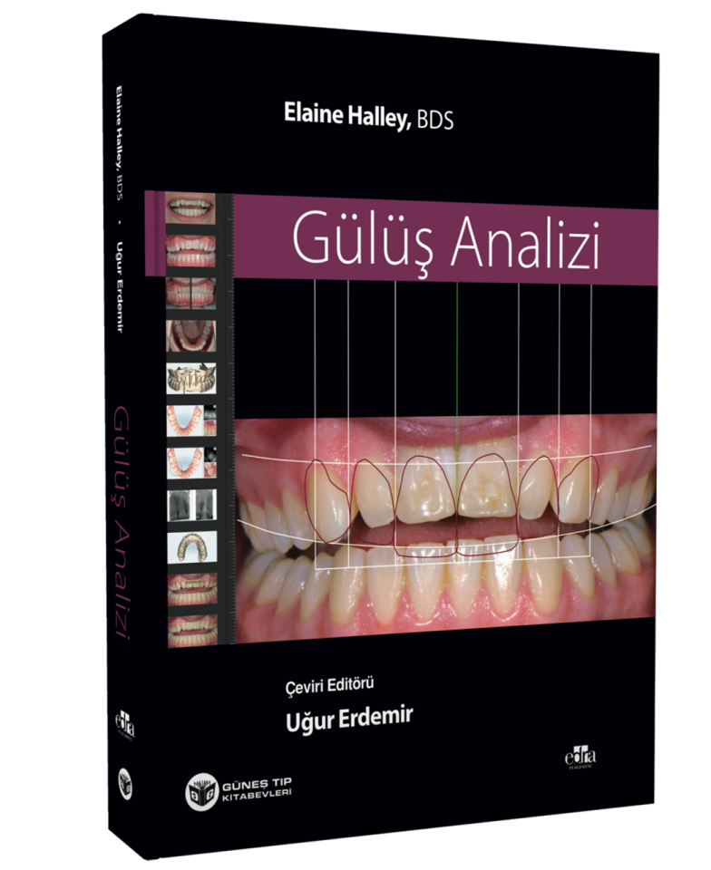 Gülüş Analizi