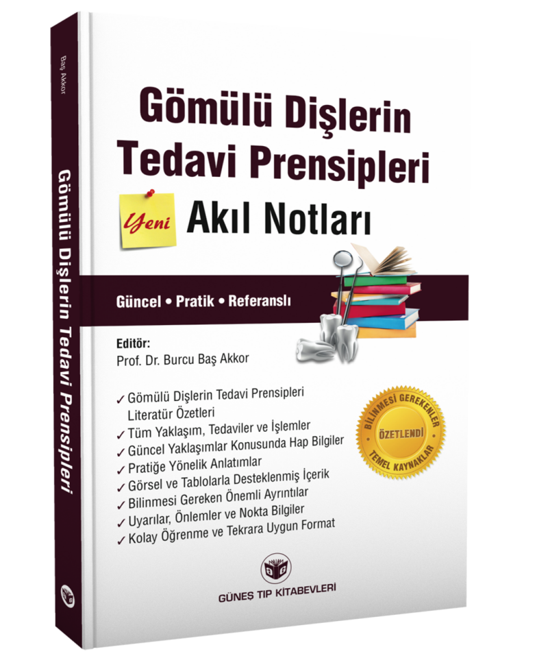 Gömülü Dişlerin Tedavi Prensipleri Akıl Notları