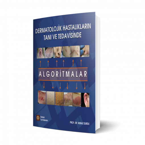 Dermatolojik Hastalıkların Tanı ve Tedavisinde Algoritmalar