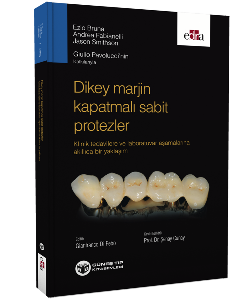 Dikey Marjin Kapatmalı Sabit Protezler