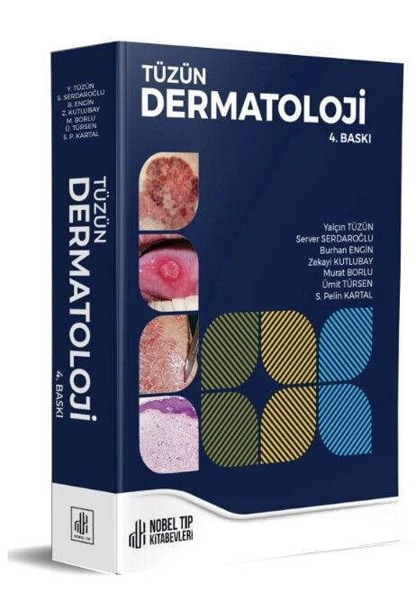 Tüzün Dermatoloji 4.Baskı