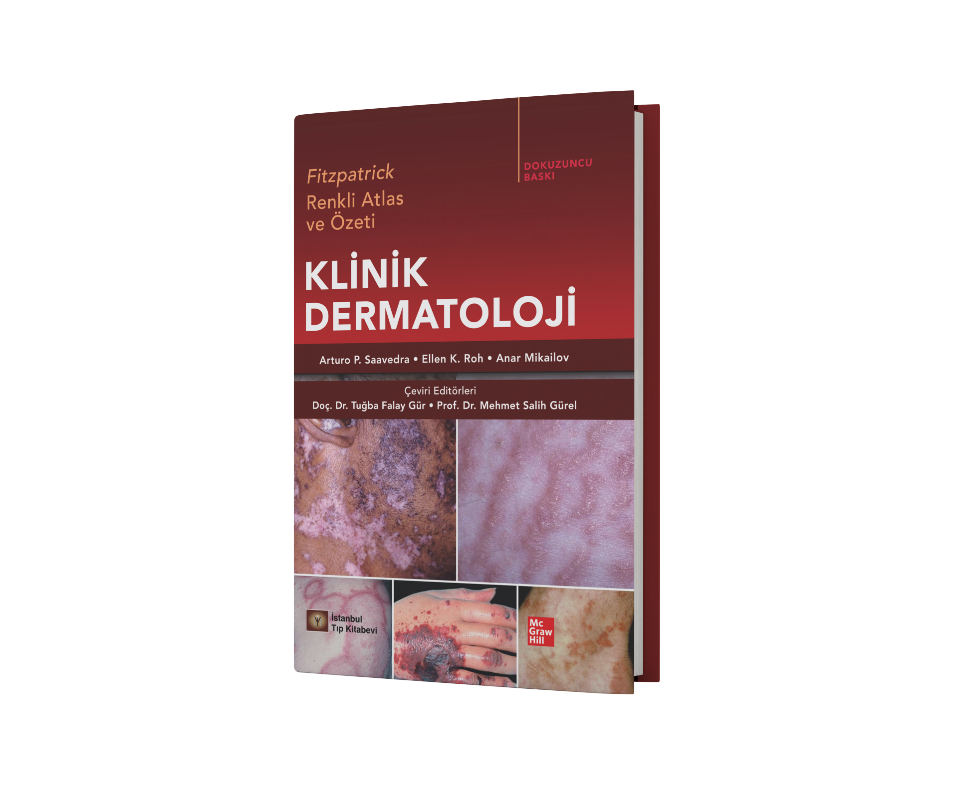 Fitzpatrick Renkli Atlas ve Özeti Klinik Dermatoloji