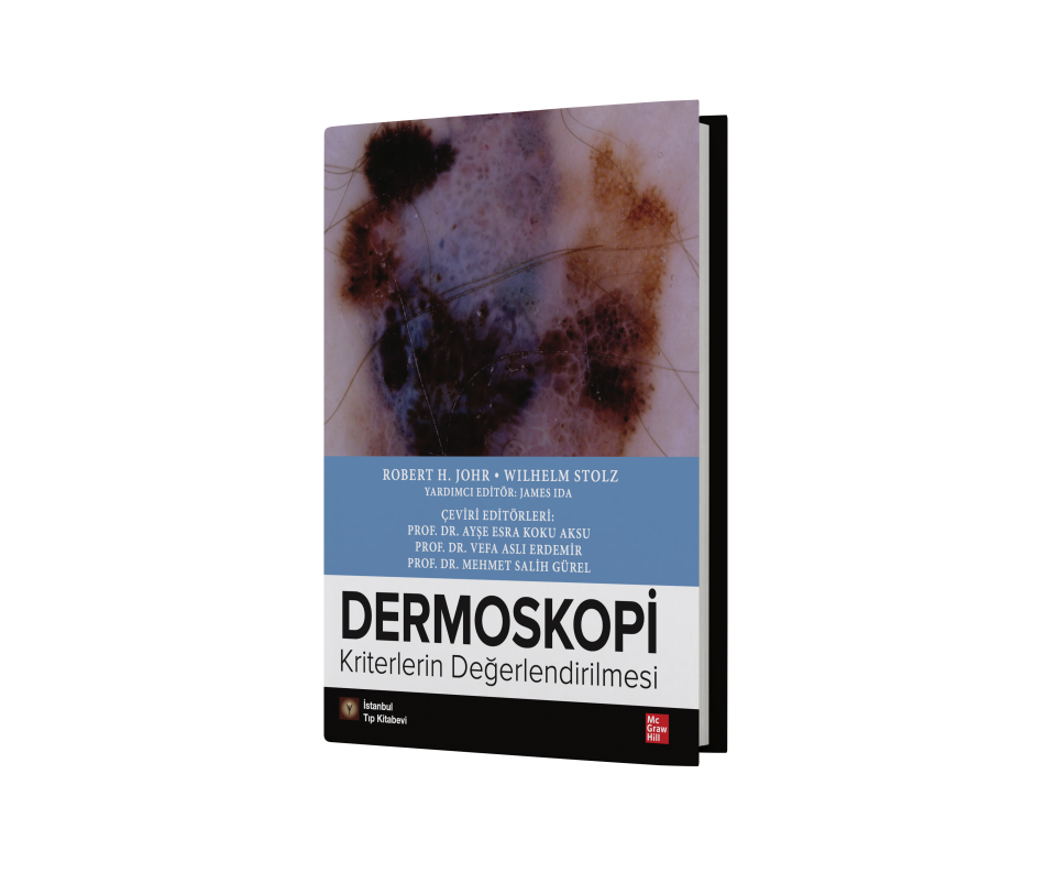 Dermoskopi Kriterlerin Değerlendirilmesi