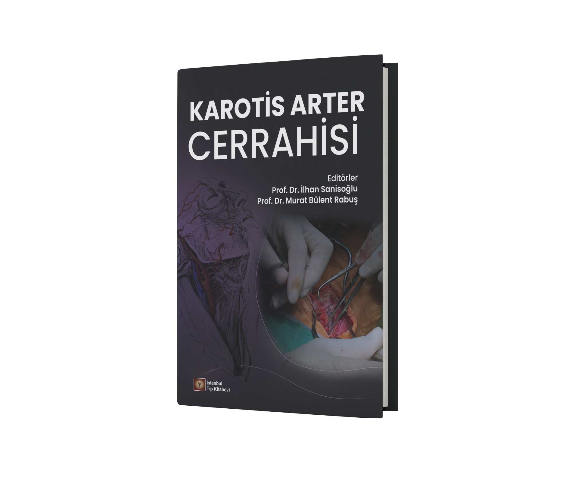 Karotis Arter Cerrahisi