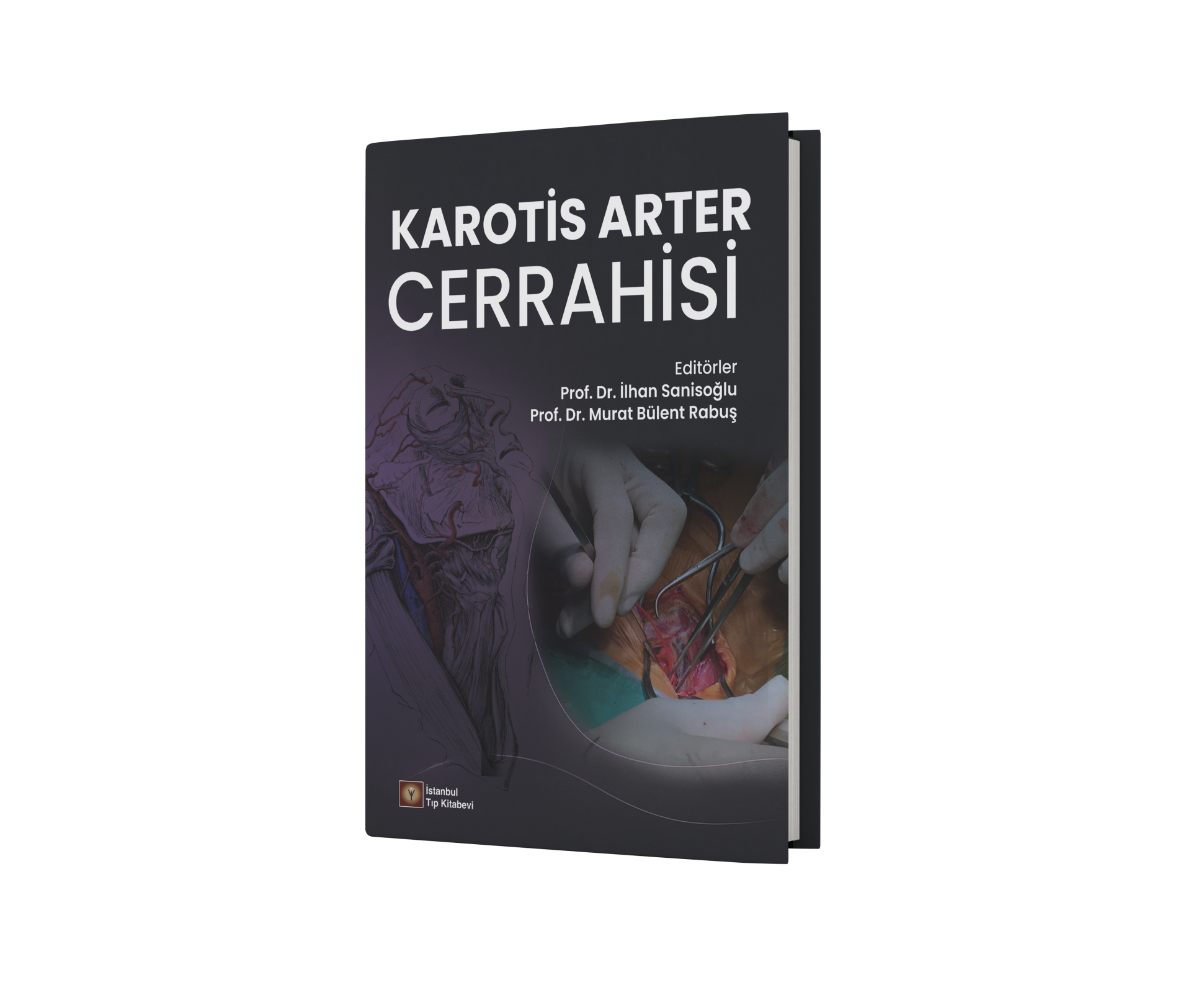 Karotis Arter Cerrahisi