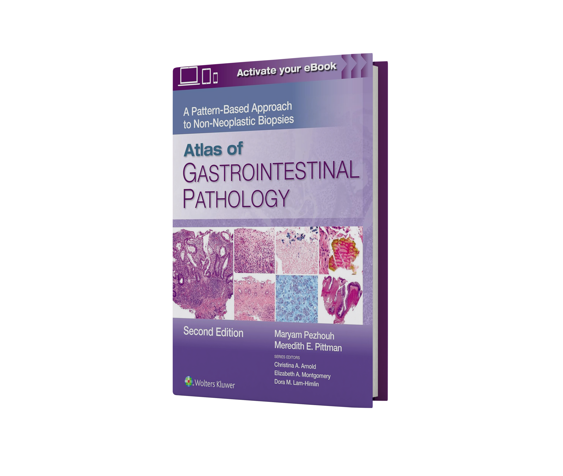 Atlas of Gastrointestinal Pathology: A Pattern Based Approach to Neoplastic Biopsies