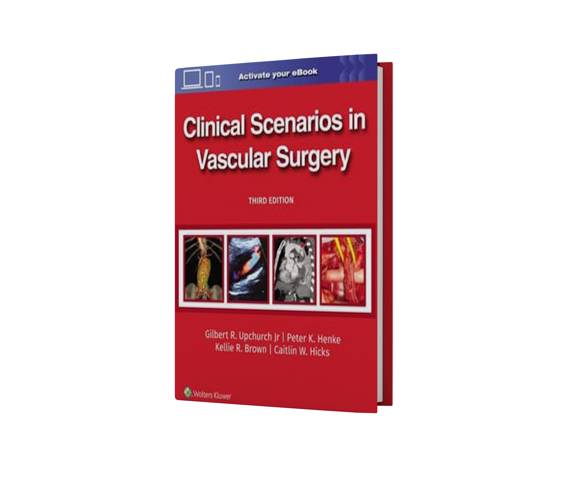 Clinical Scenarios in Vascular Surgery