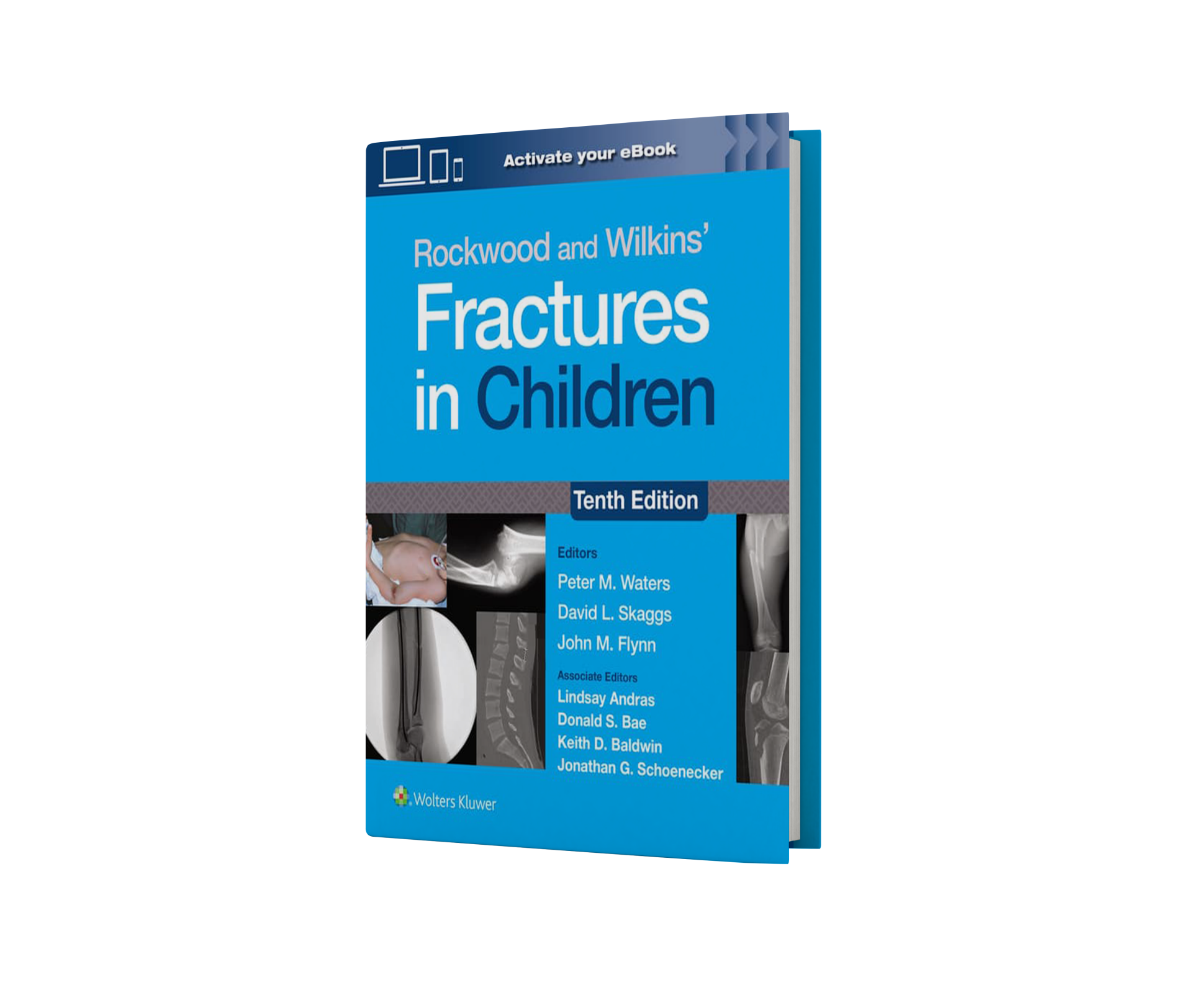 Rockwood and Wilkins' Fractures in Children: Print + eBook with Multimedia