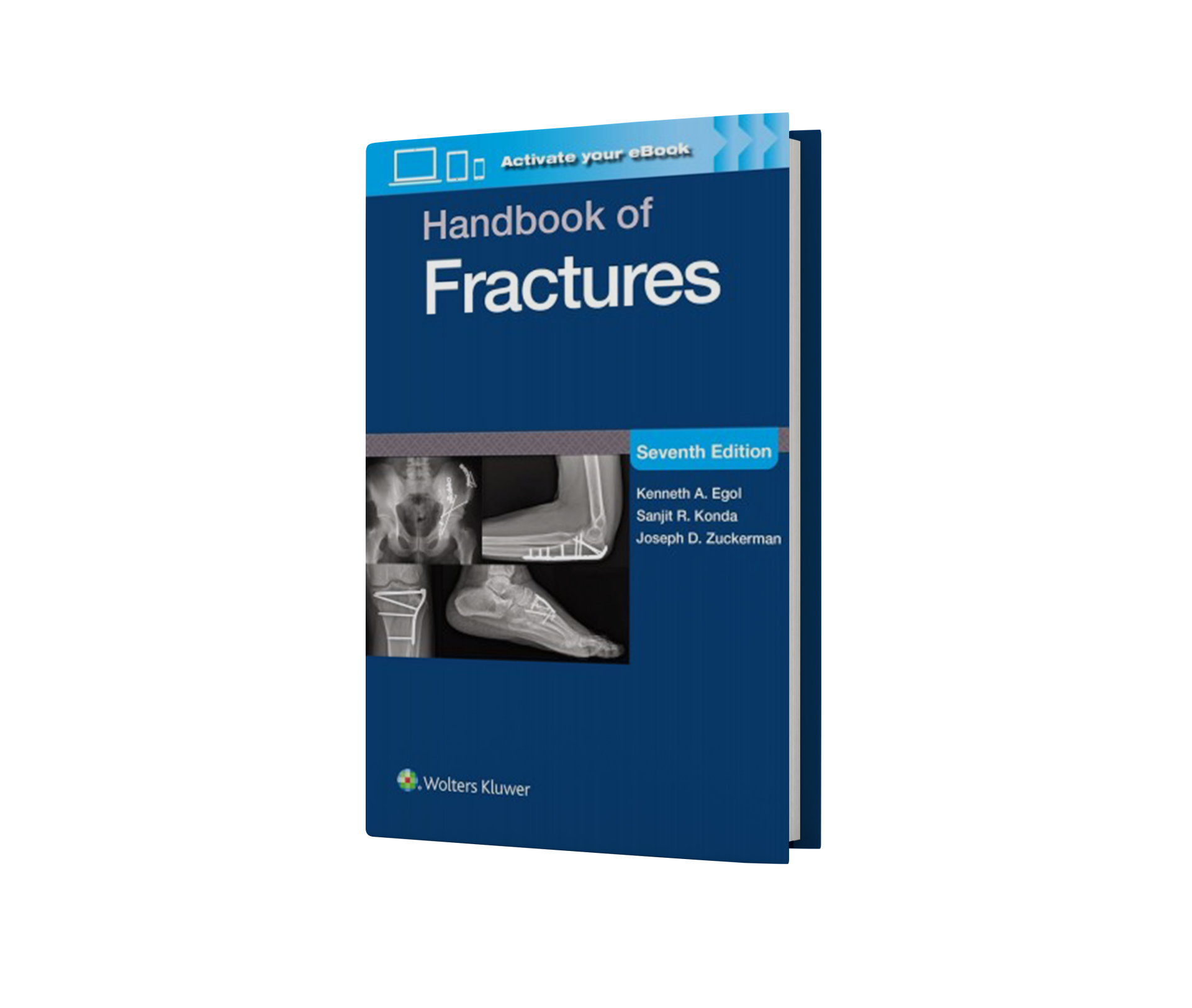 Handbook of Fractures Print + eBook with Multimedia,7 Edition