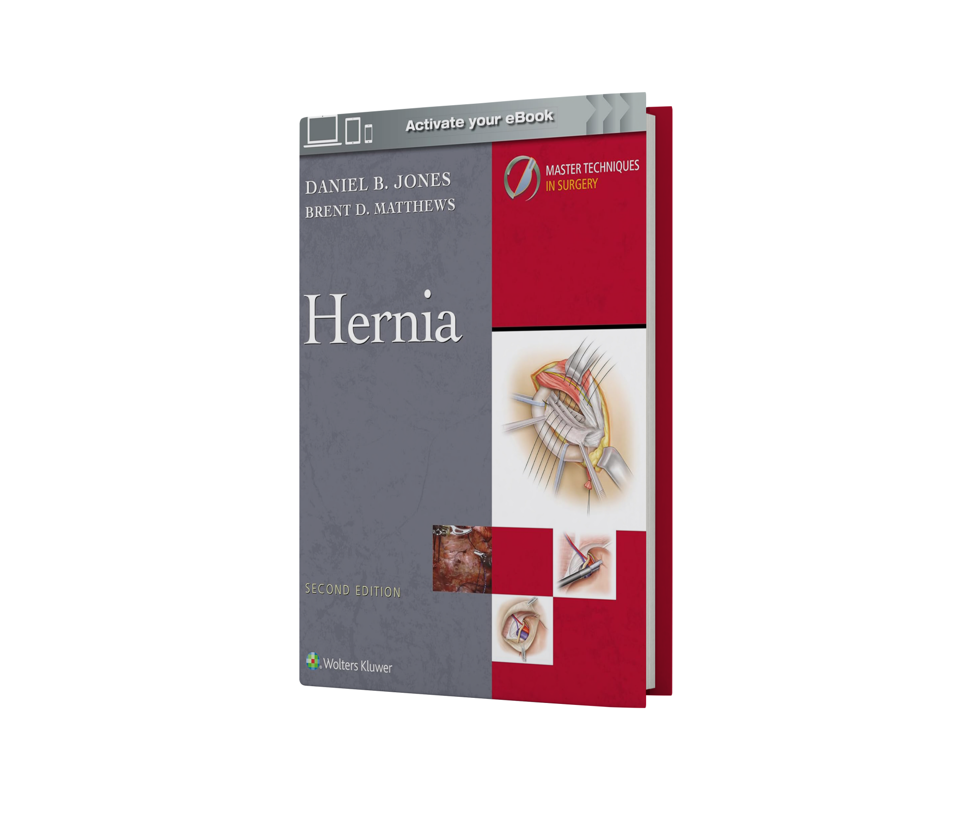 Master Techniques in Surgery: Hernia: Print + eBook with Multimedia