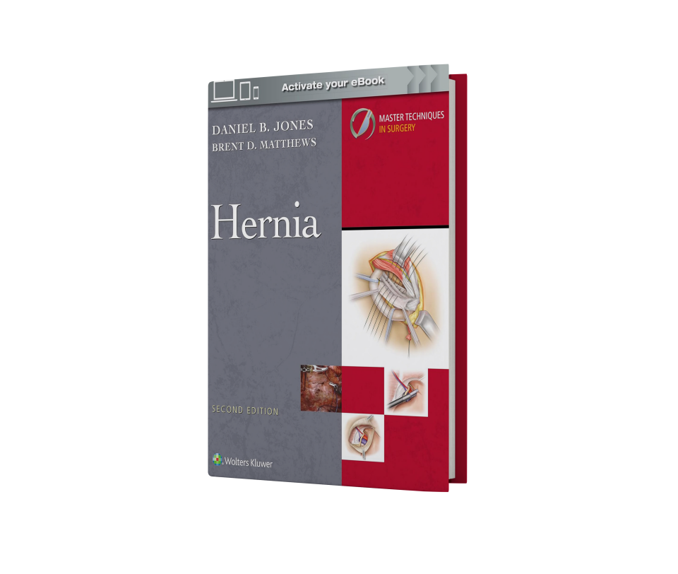 Master Techniques in Surgery: Hernia: Print + eBook with Multimedia