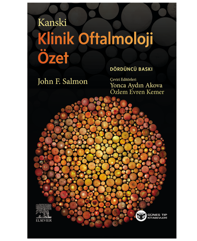 Kanski Klinik Oftalmoloji Özet