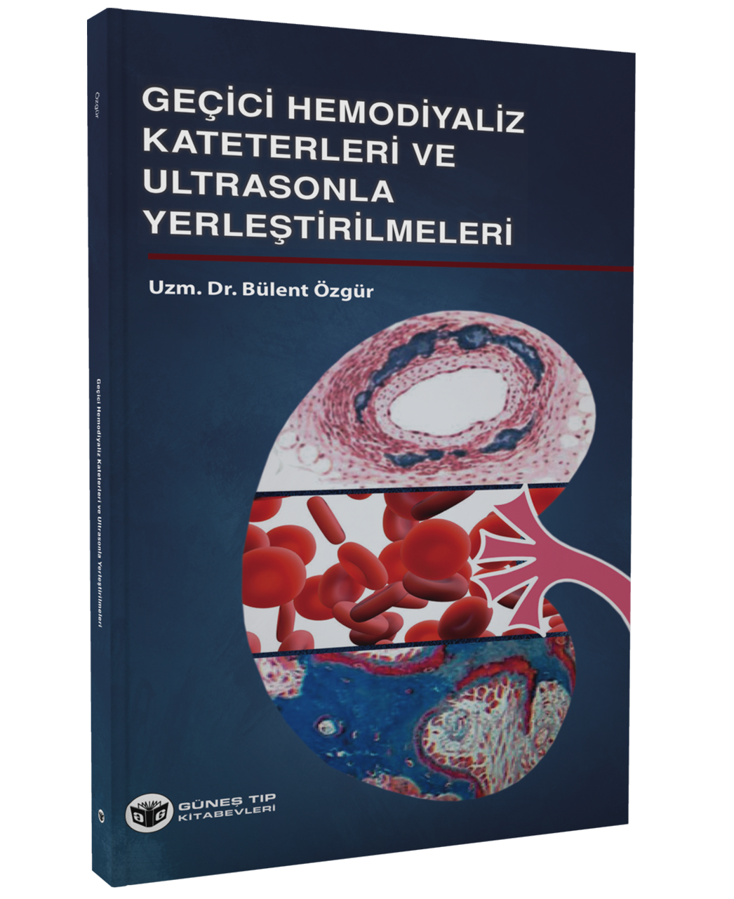 Geçici Hemodiyaliz Kateterleri ve Ultrasonla Yerleştirilmeleri