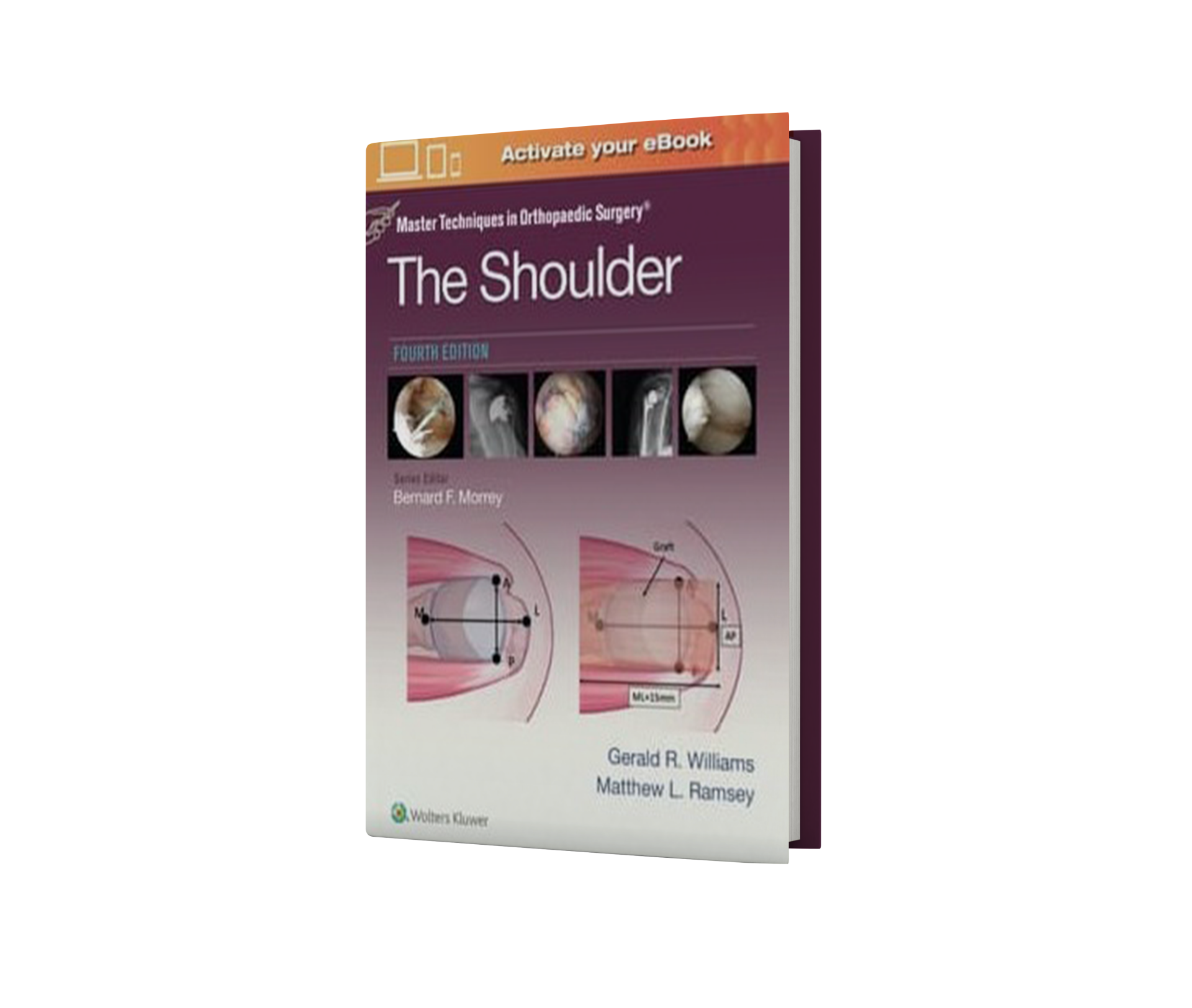 Master Techniques in Orthopaedic Surgery: The Shoulder: Print + eBook with Multimedia, 4th Edition