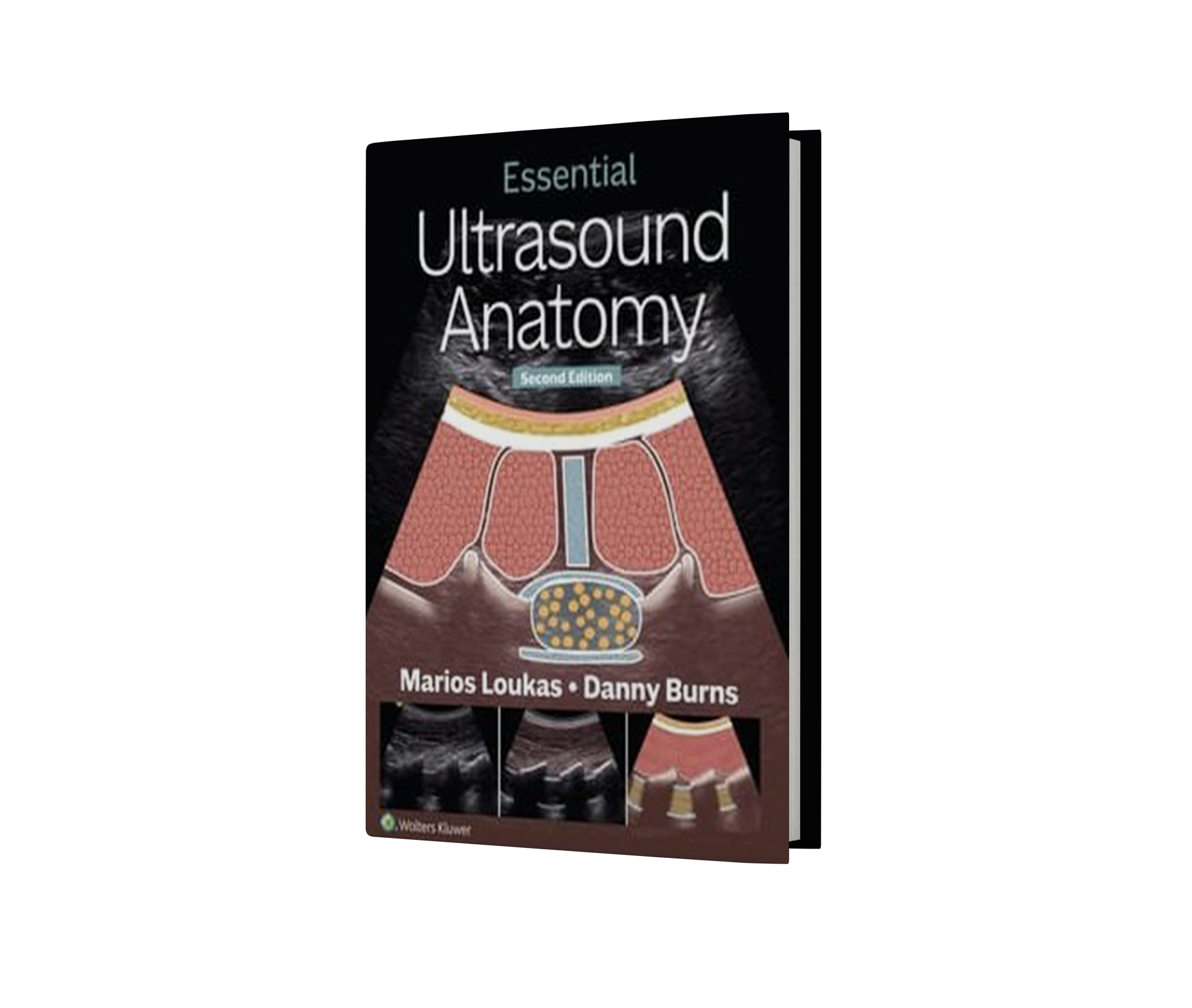 Essential Ultrasound Anatomy 2st Edition