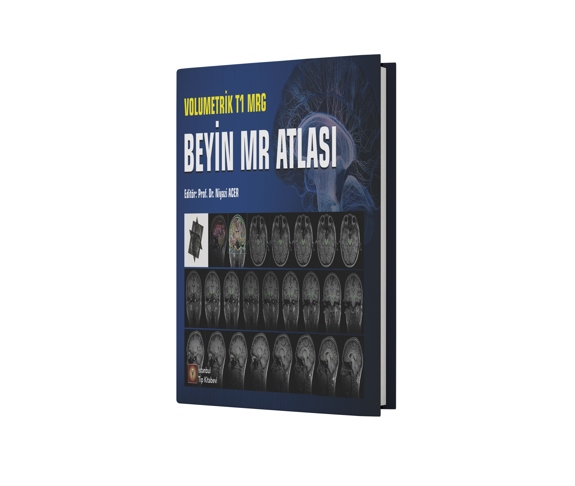 Volumetrik T1 MRG Beyin MR Atlası