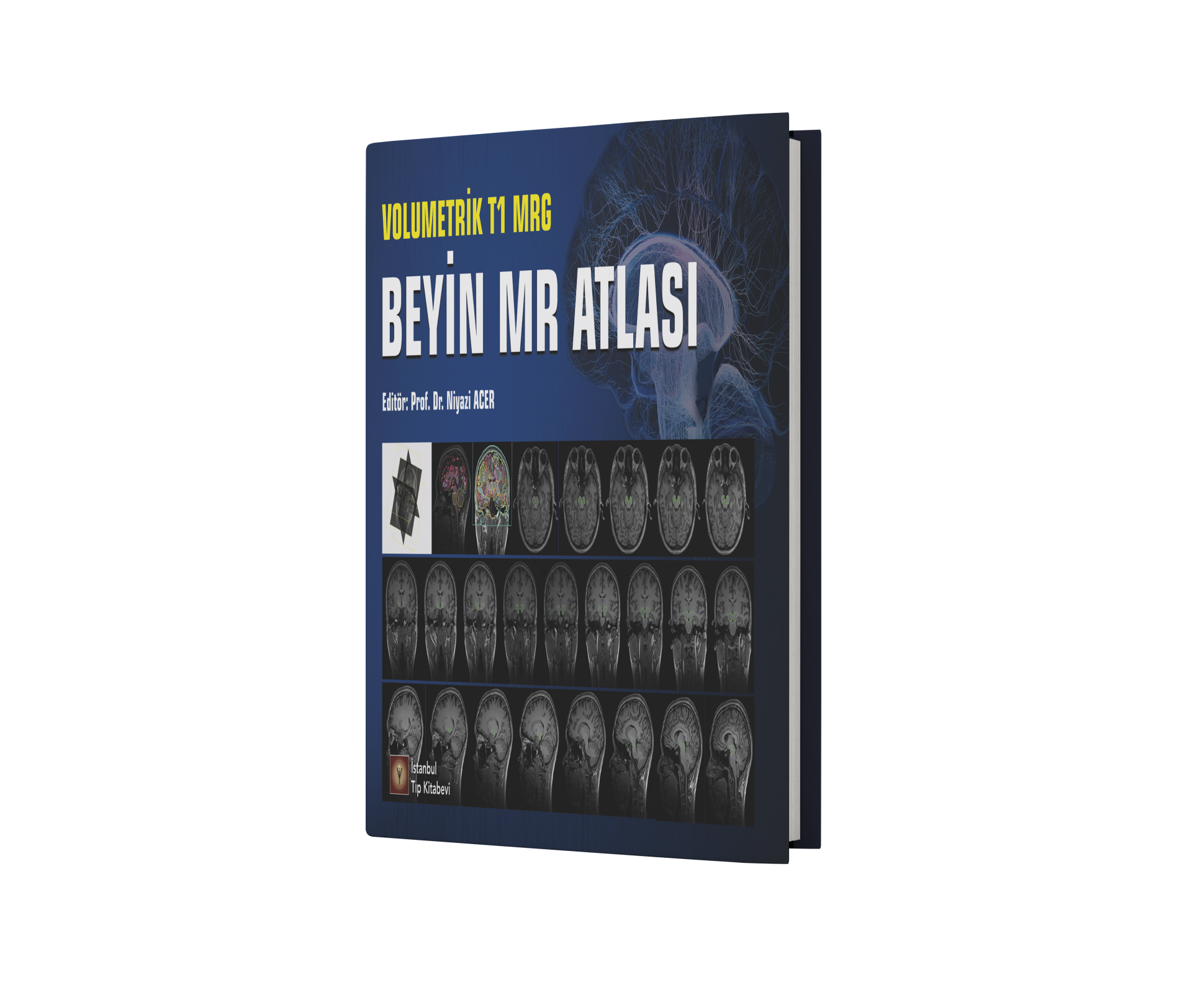 Volumetrik T1 MRG Beyin MR Atlası