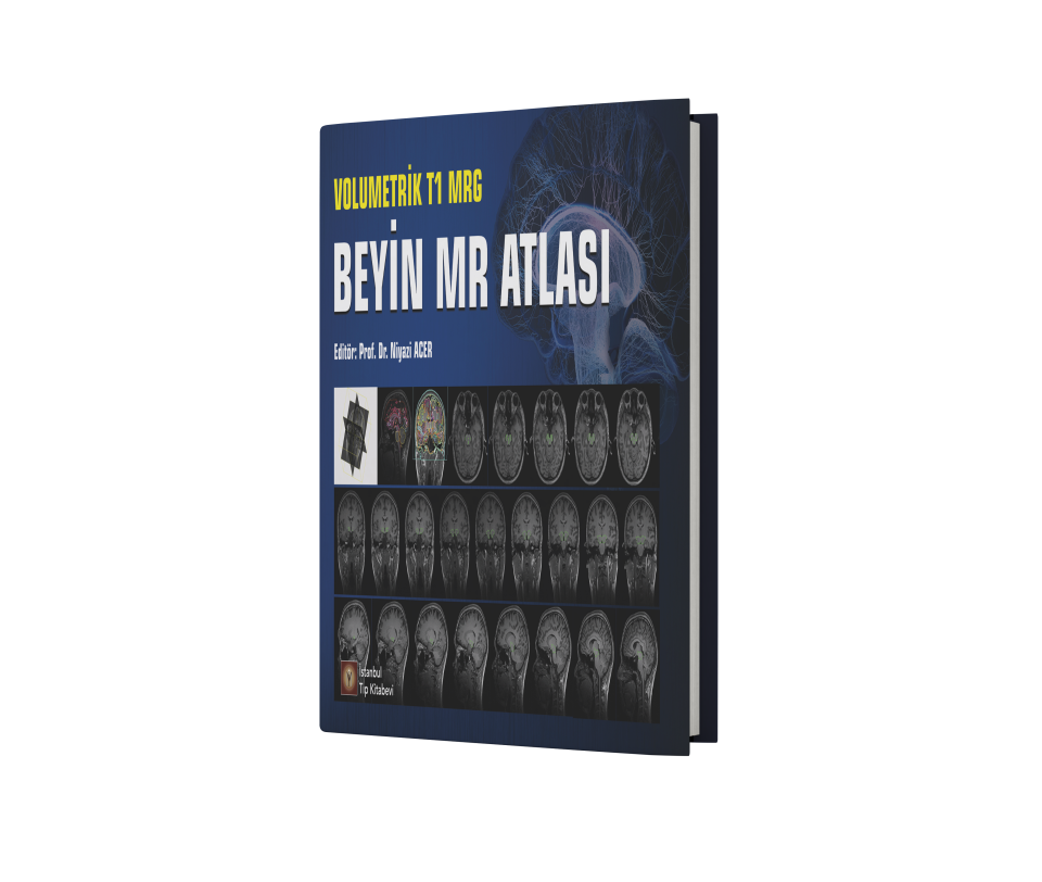 Volumetrik T1 MRG Beyin MR Atlası