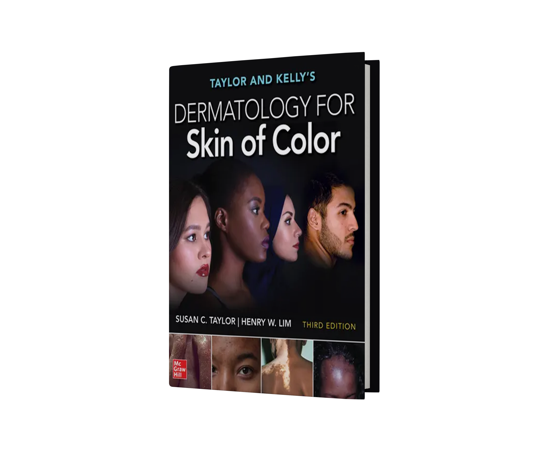 Taylor and Kelly's Dermatology for Skin of Color, Third Edition