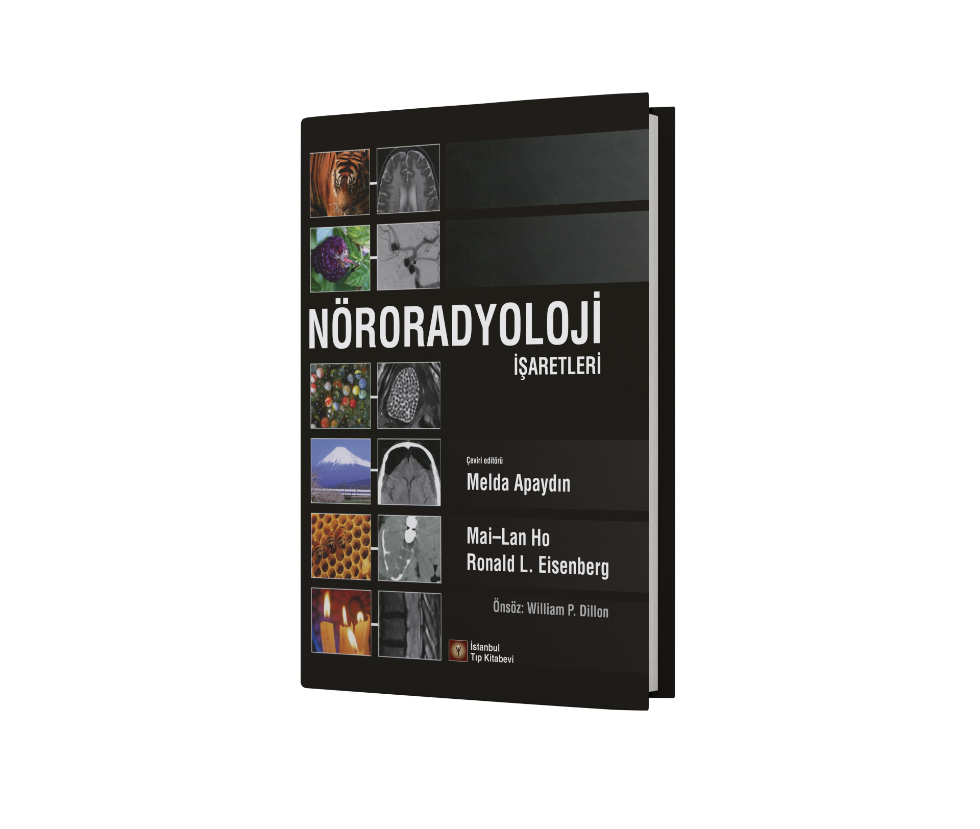 Nöroradyoloji İşaretleri