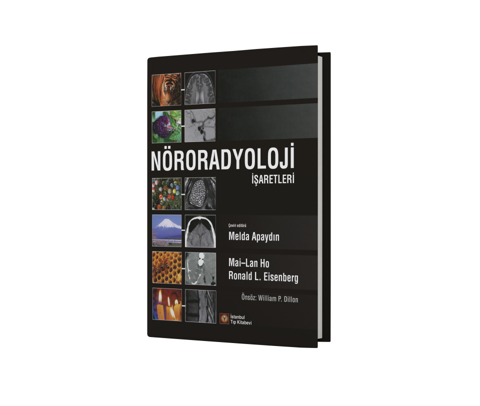 Nöroradyoloji İşaretleri