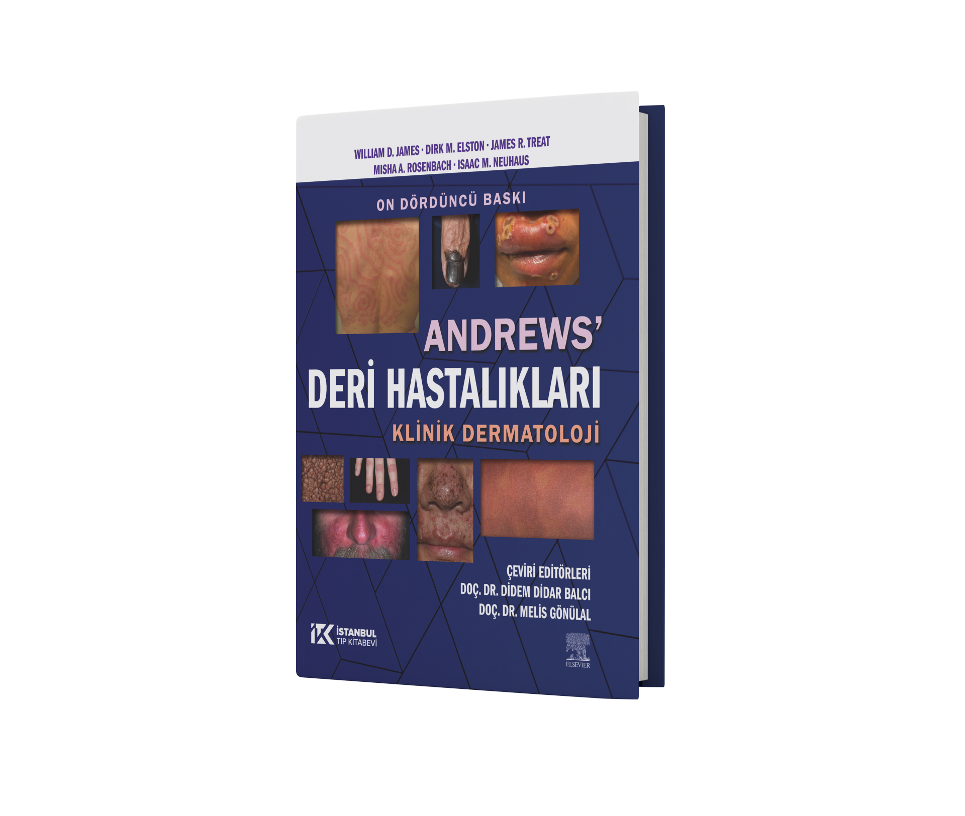 Andrews Deri Hastalıkları