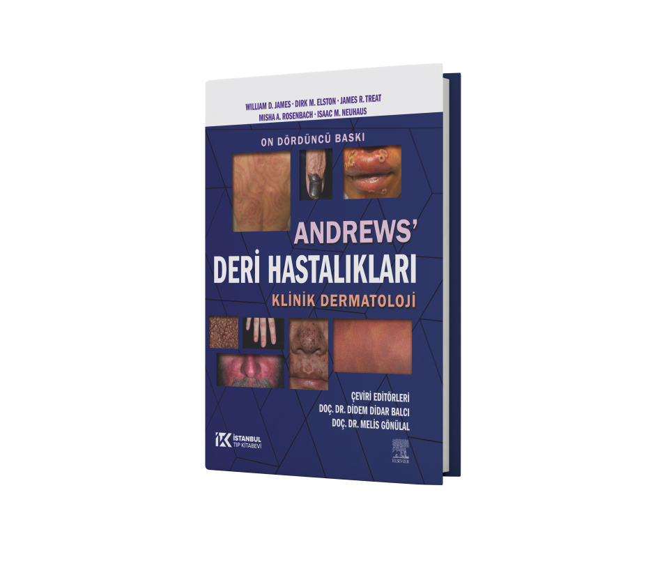 Andrews Deri Hastalıkları