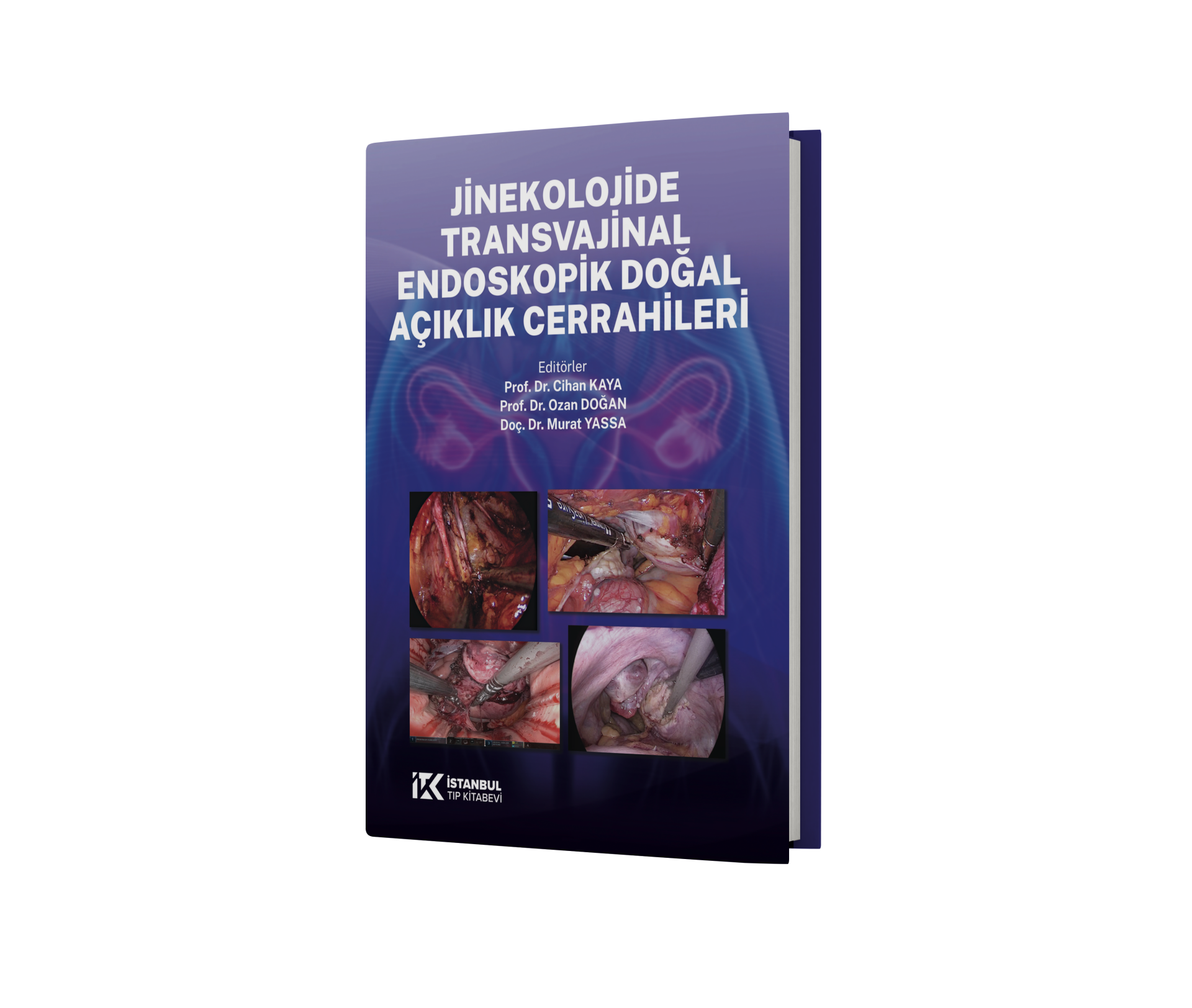 Jinekolojide Transvajinal Endoskopik Doğal Açıklık Cerrahileri