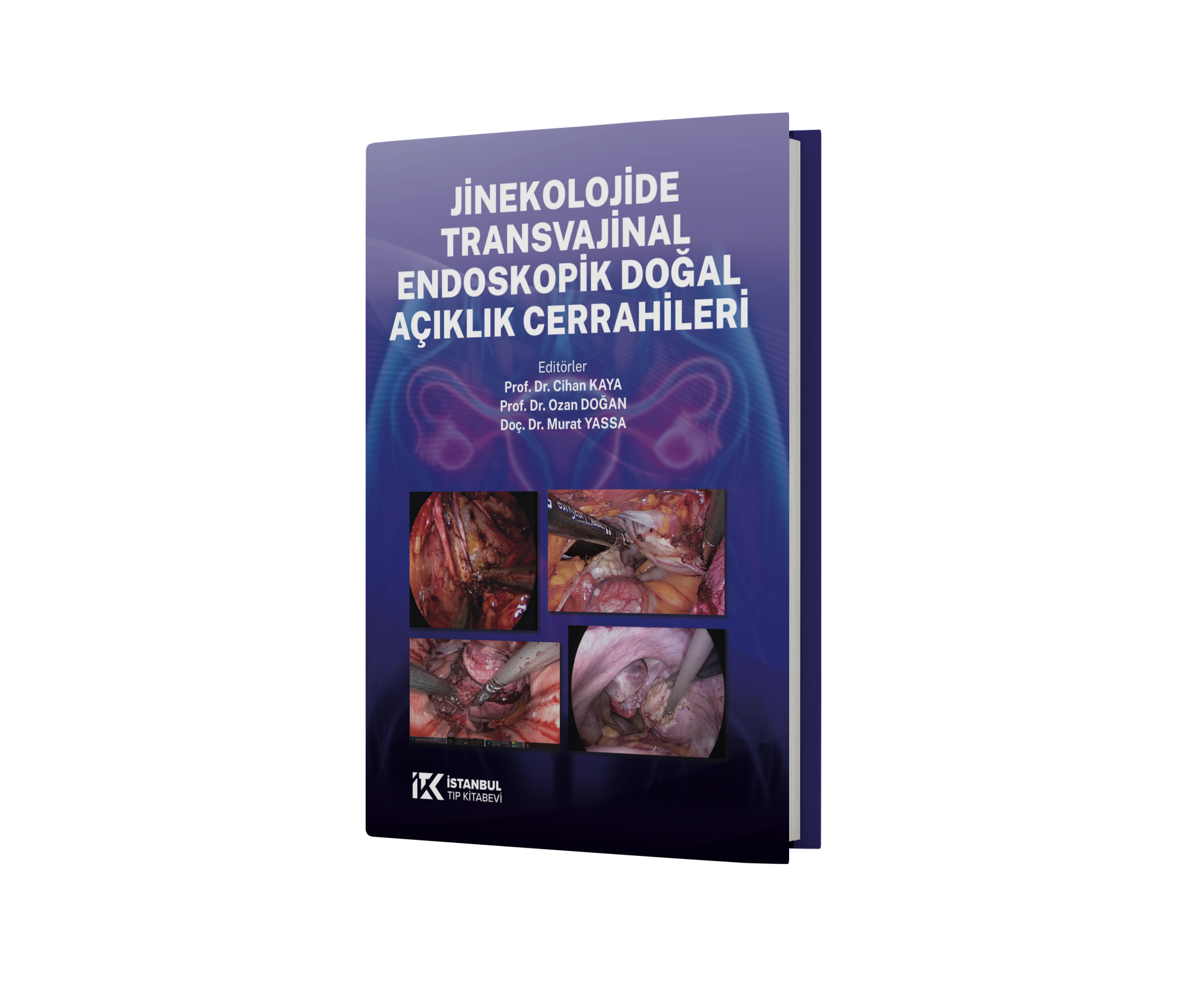 Jinekolojide Transvajinal Endoskopik Cerrahi