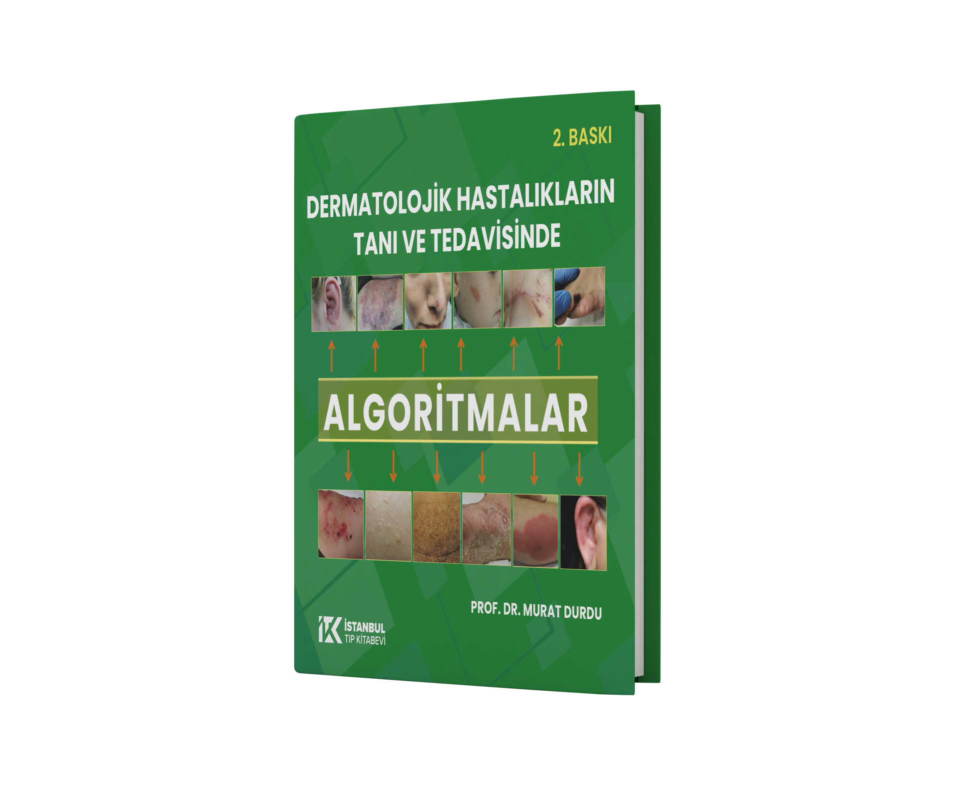 Dermatolojik Hastalıkların Tanı ve Tedavisinde Algoritmalar