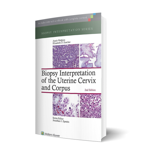 Biopsy Interpretation of the Uterine Cervix and Corpus (Biopsy Interpretation Series) Second Edition