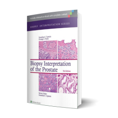 Biopsy Interpretation of the Prostate