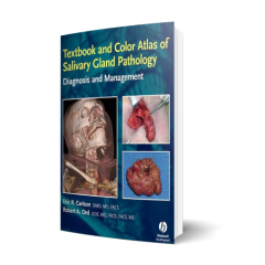 Textbook and Color Atlas of Salivary Gland Pathology: Diagnosis and Management 1st Edition