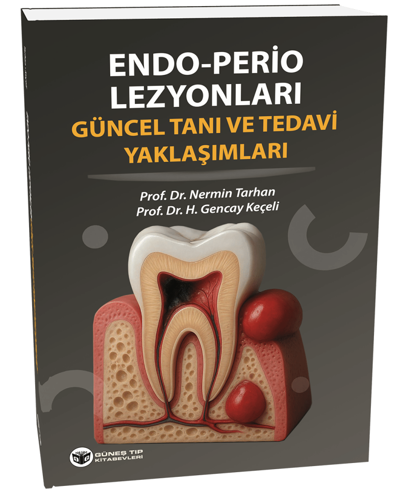 Endo - Perio Lezyonları Güncel Tanı ve Tedavi Yaklaşımları