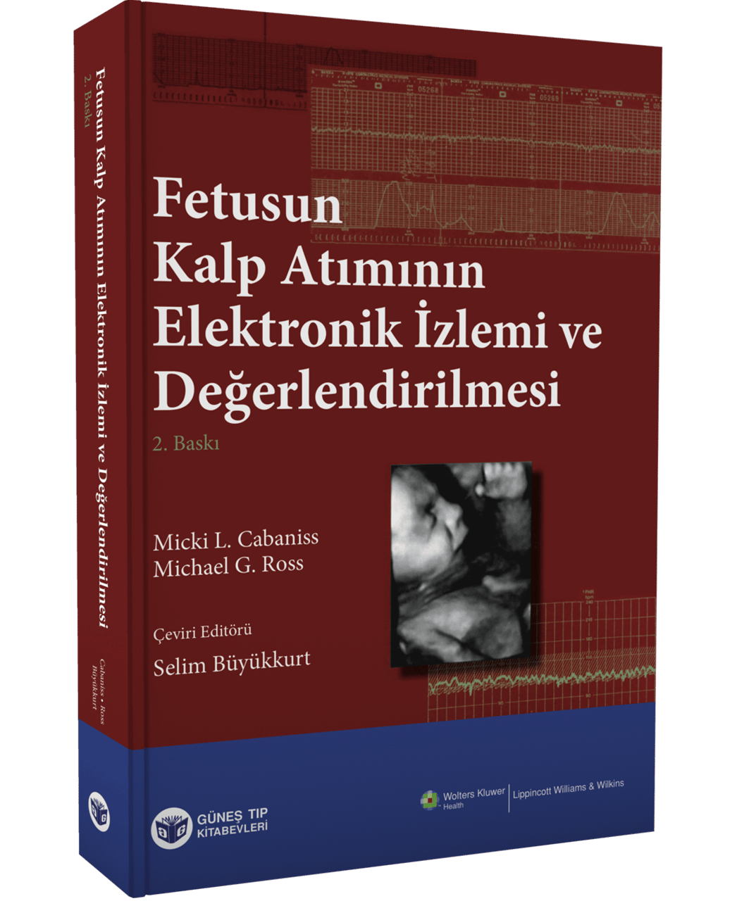 Fetusun Kalp Atımının Elektronik İzlemi ve Değerlendirilmesi