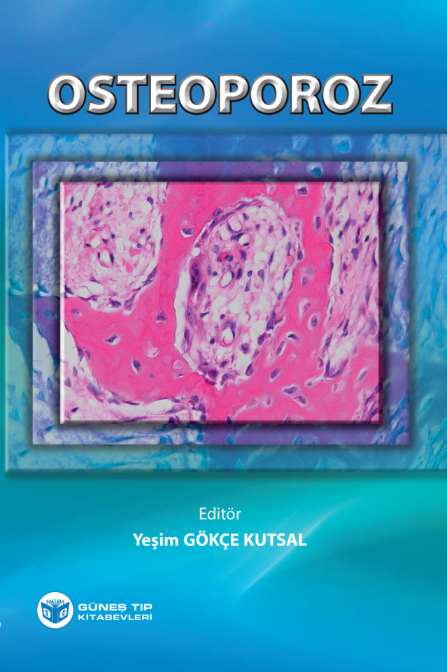 Osteoporoz