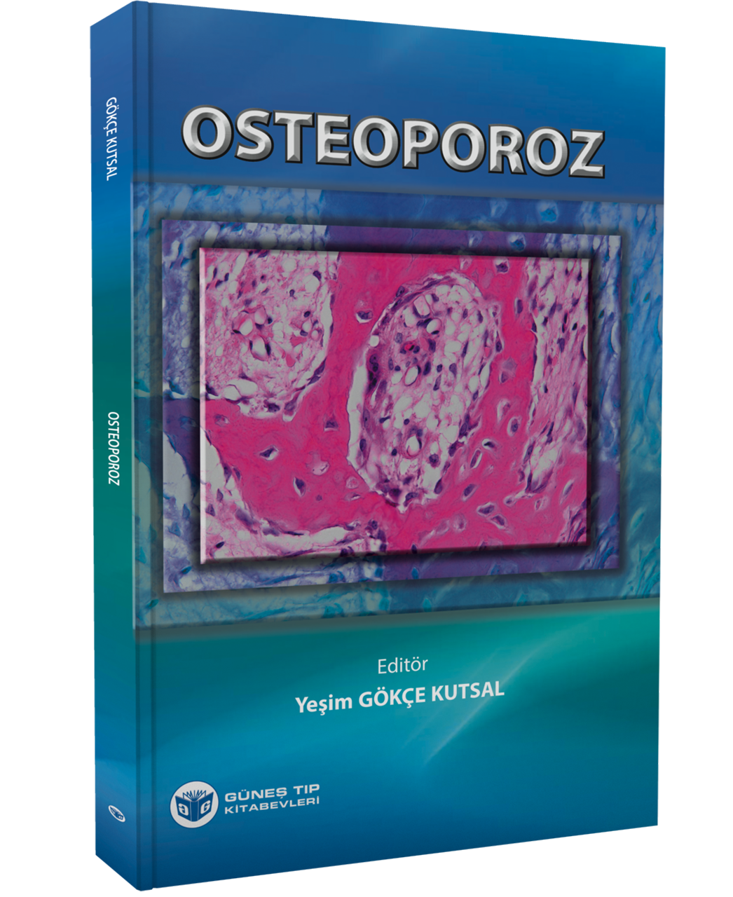 Osteoporoz