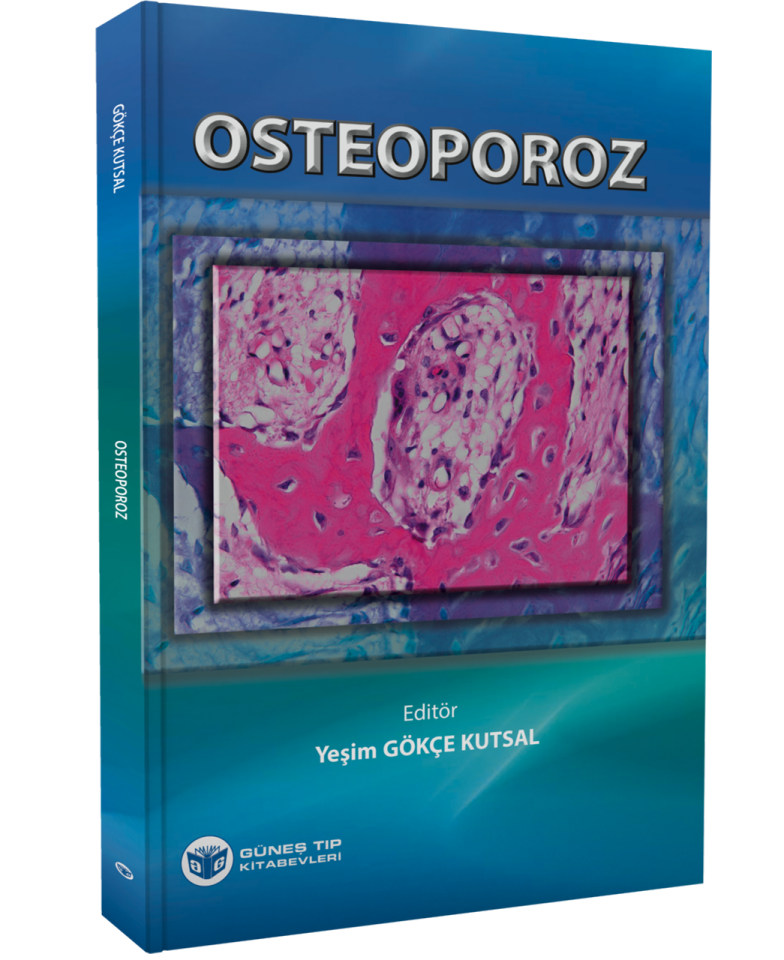 Osteoporoz