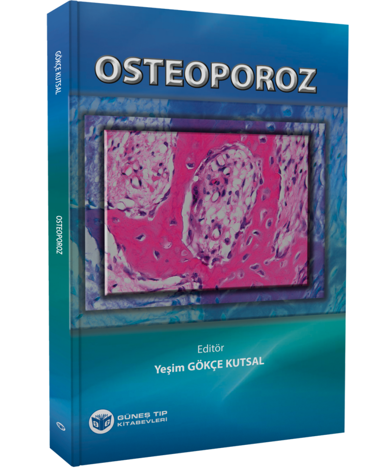 Osteoporoz
