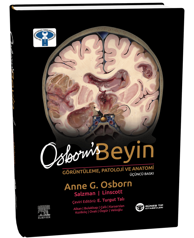 Osborn's Beyin Görüntüleme, Patoloji ve Anatomi 3. Baskı