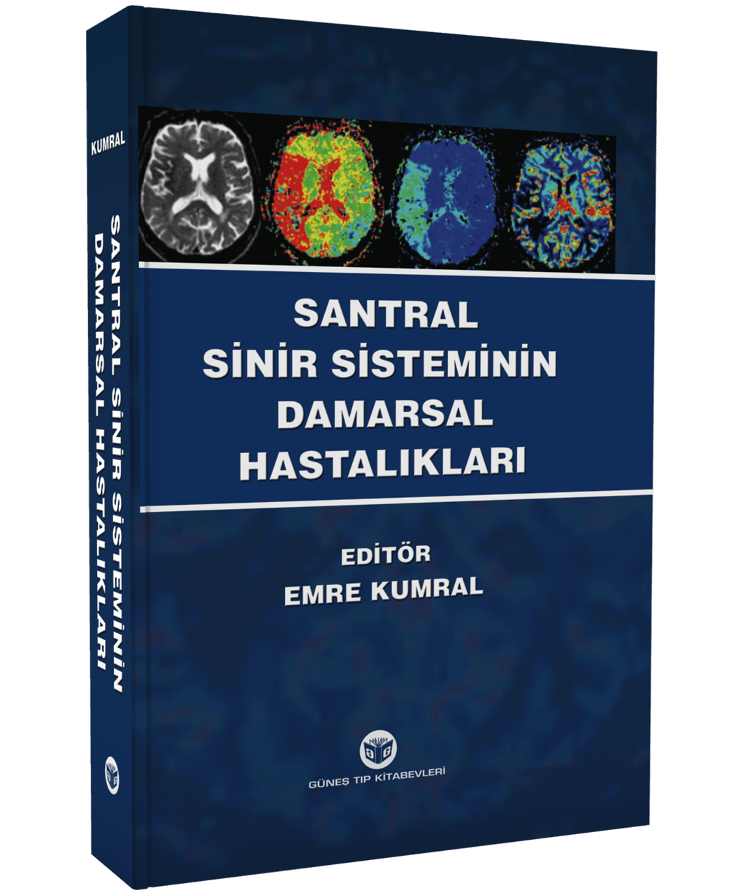 Santral Sinir Sisteminin Damarsal Hastalıkları
