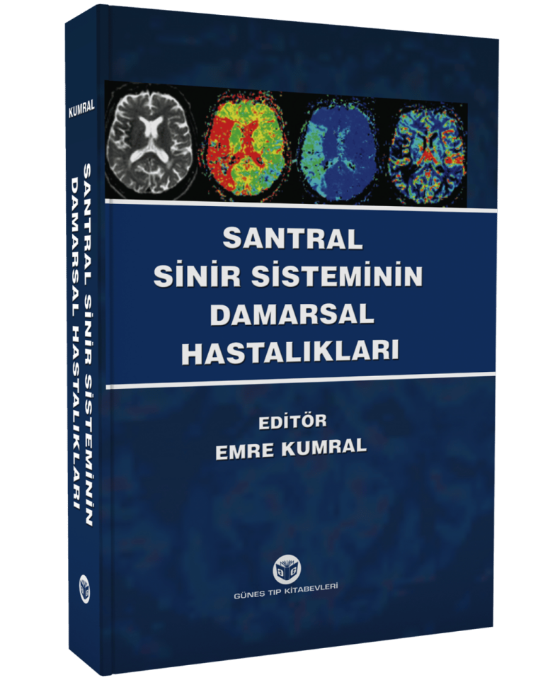Santral Sinir Sisteminin Damarsal Hastalıkları