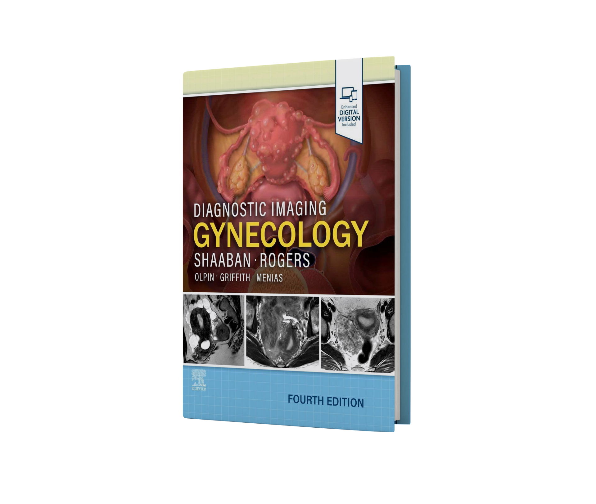 Diagnostic Imaging Gynecology, 4th Edition