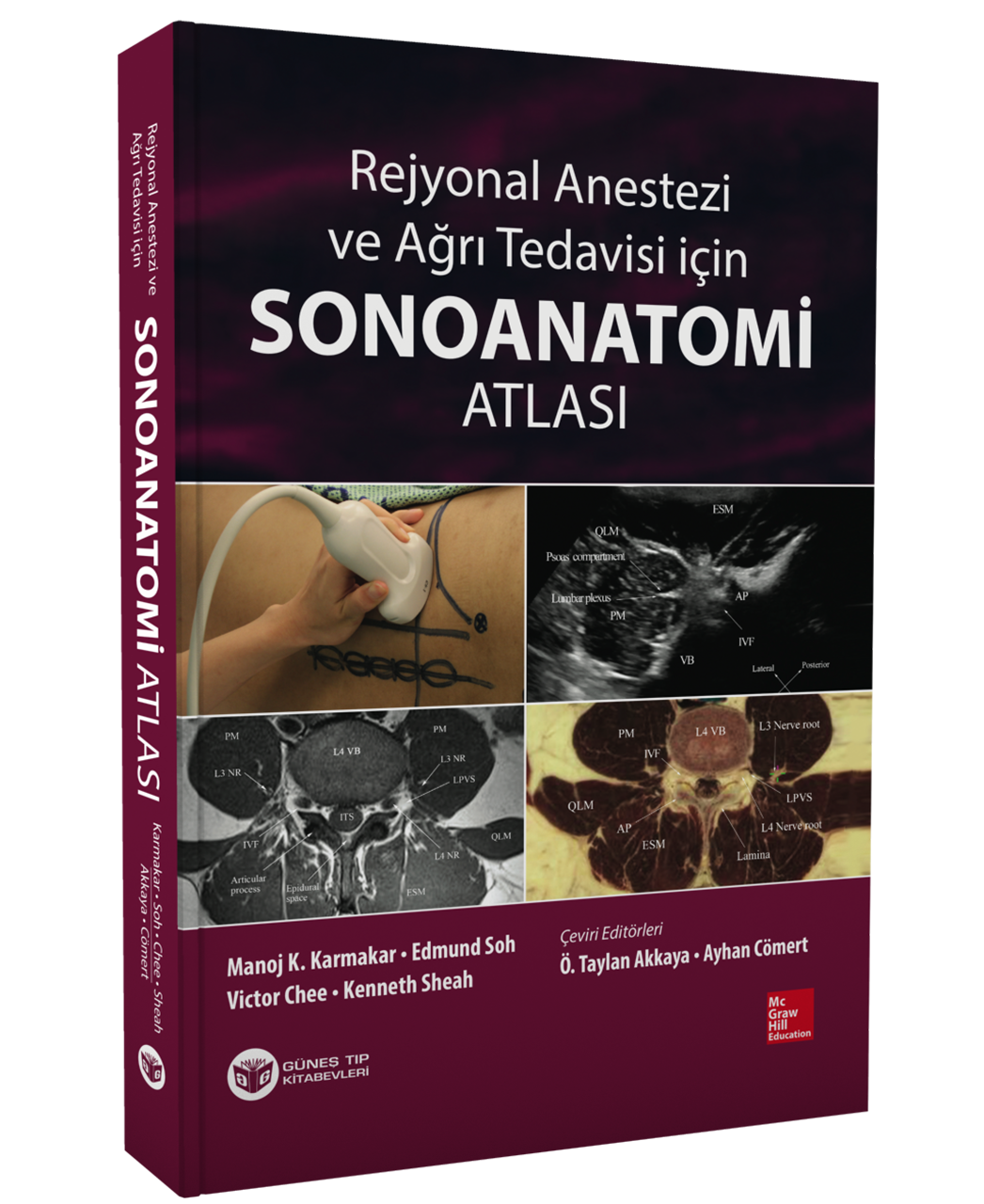 Rejyonal Anestezi ve Ağrı Tedavisi İçin Sonoanatomi Atlası