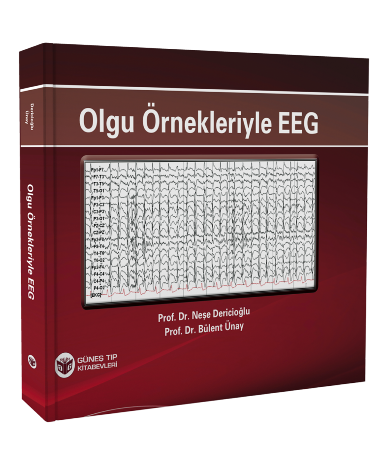 Olgu Örnekleriyle EEG