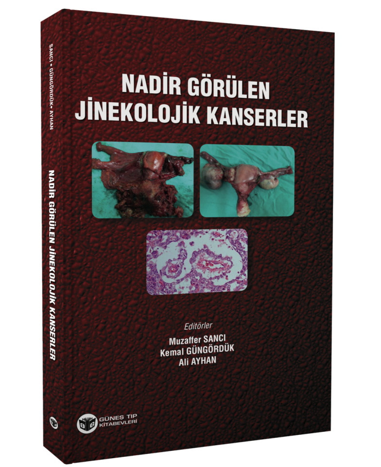 Nadir Görülen Jinekolojik Kanserler