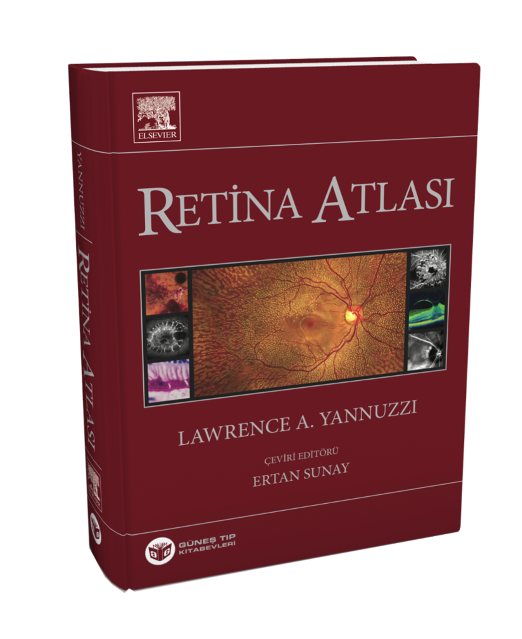 Yannuzzi Retina Atlası
